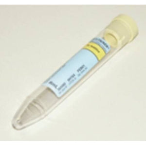 364980 > BD Vacutainer® Urinalysis Tube Conical Bottom Plain 16 X 100 ...
